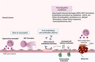 Mucocutaneous manifestations of Behçet’s disease: Pathogenesis and management from perspectives of vasculitis